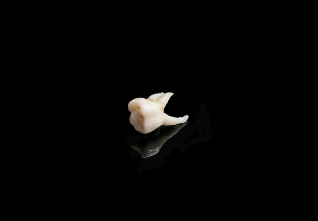 A white tooth laying on a black background