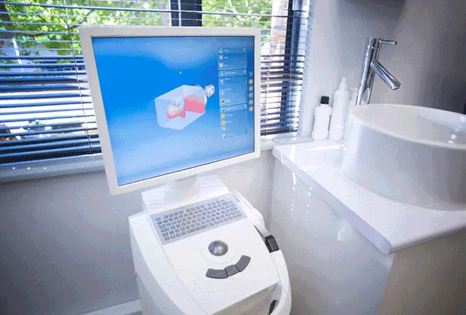 iTero Dental Digital Camera in Dracut, MA at Lakeview Family Dentists